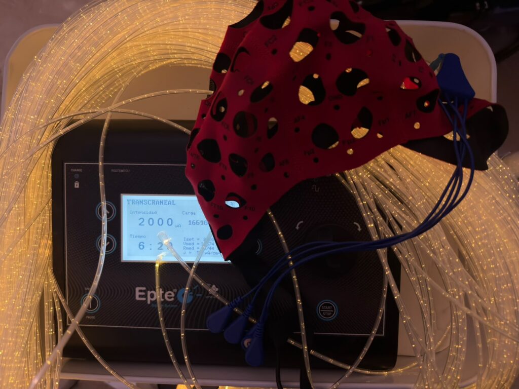 Cuando sentir también es rehabilitar: integración sensorial y tDCS en neurorrehabilitación